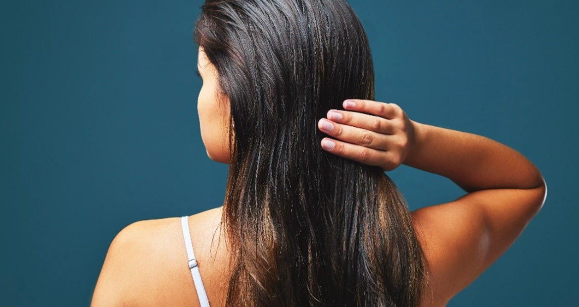 Como Acabar Com Oleosidade Do Cabelo Min